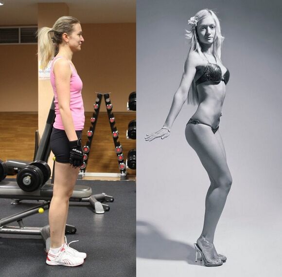 antes y después del aumento de senos corrigiendo la postura